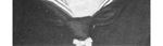 Albin Eggerstedt